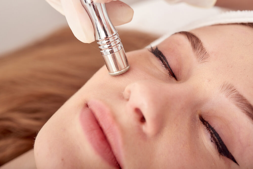 hyperpigmentation clinic birmingham- procedure of microdermabrasion skin treatment