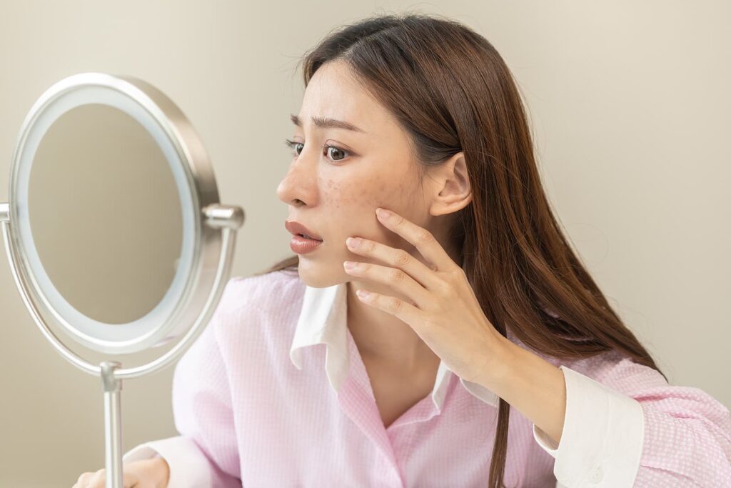 hyperpigmentation clinic birmingham - woman looking mirror hand touch facial at dark spot
