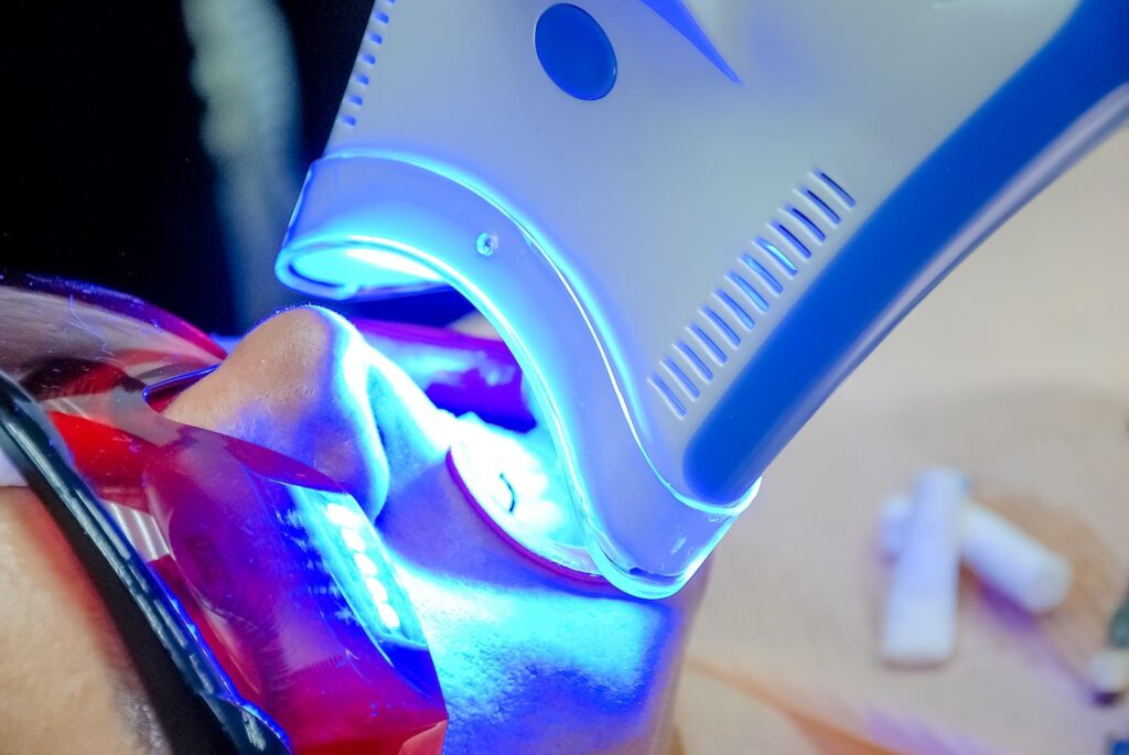 teeth whitening clinic birmingham - female receiving teeth whitening procedure