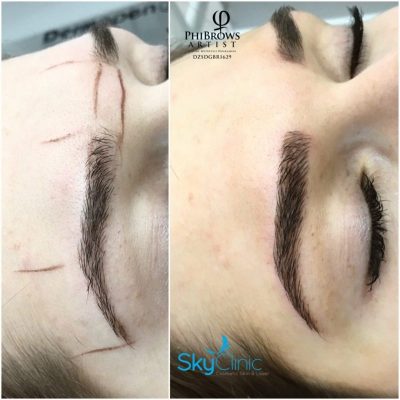 Perfect Eyebrows Microblading Sky Clinic