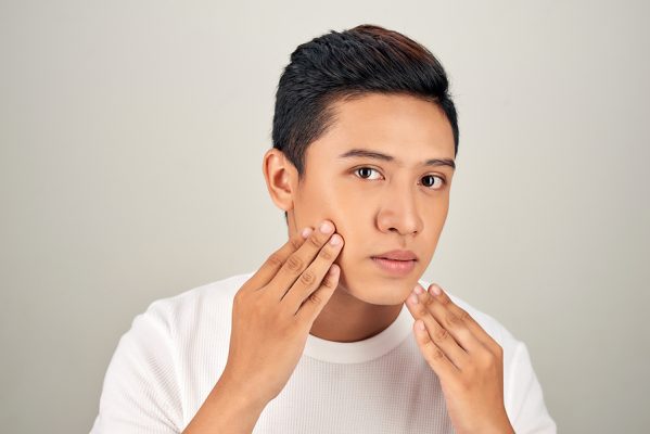 acne treatment - man checking scarring