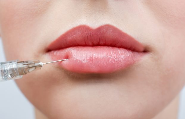 dermal fillers windsor - woman receiving filler injection in lips