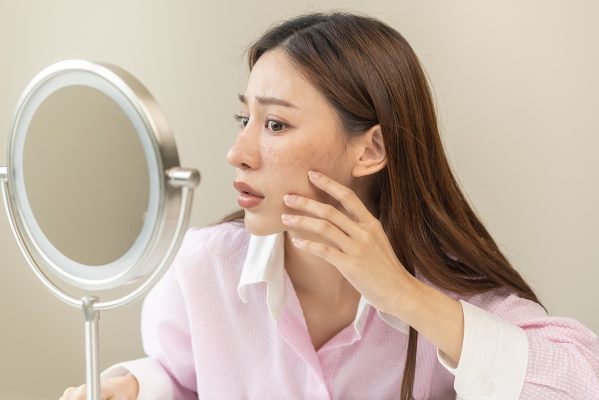 hyperpigmentation clinic birmingham - woman looking mirror hand touch facial at dark spot