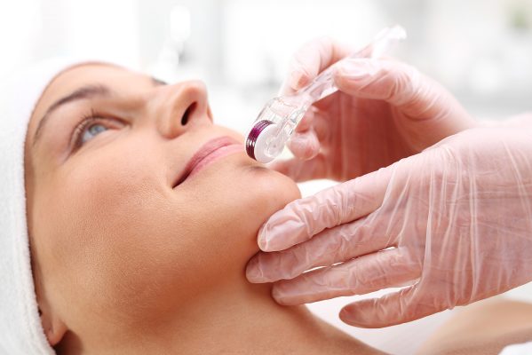 laser clinic windsor - mesotherapy treatment on a woman's face
