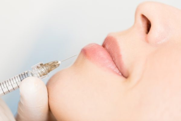 lip fillers windsor - Closeup of dermal fillers being injected in lips