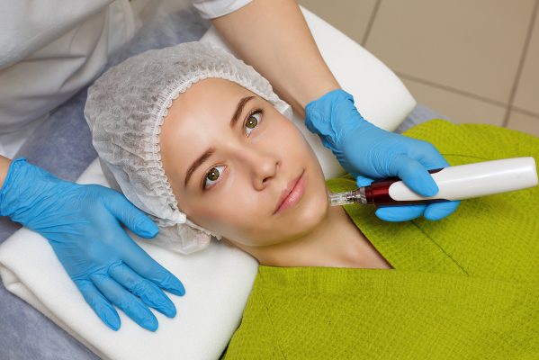 skin clinic windsor - dermapen treatment of the chin zone